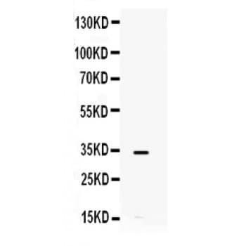Polyclonal Rabbit anti-Human IL8 / Interleukin 8 Antibody (aa23-99, WB)