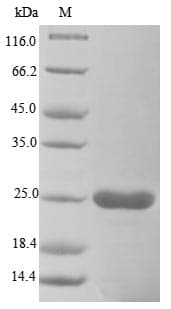 Vaccinia Virus VACWR088 Protein (Recombinant 6His, N-terminus)