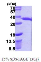 E. coli hchA Protein (Recombinant His)