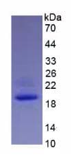 Mouse IL-1B / IL-1 Beta Protein (Recombinant His, N-Terminal)