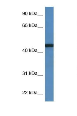 RRS1 Antibody (C-Terminus)
