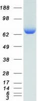 Human KARS Protein (Recombinant Myc-DDK (Flag))