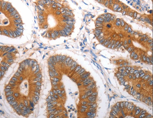 SLC12A6 / KCC3 Antibody