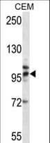 TLR2 Antibody (aa281-310)