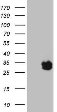 BAMBI Antibody (aa21-152, clone OTI9G4, Carrier-free)