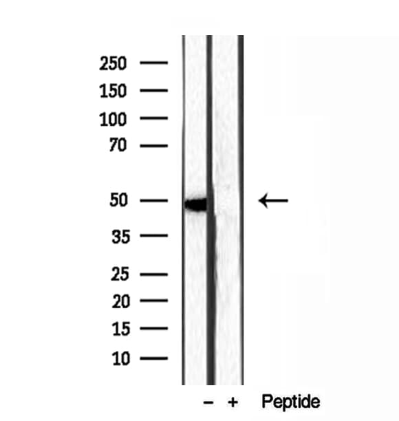 MIEF2 / SMCR7 Antibody