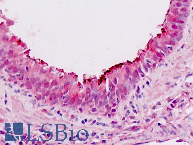 IHC-plus™ SIX4 Antibody (clone 3B8)
