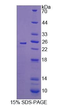 Rat IL17C Protein (Recombinant His, N-Terminal)