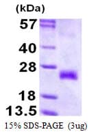 Human TNFRSF9 / 4-1BB / CD137 Protein (Recombinant His)