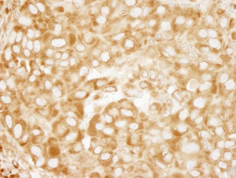 RPL7 / Ribosomal Protein L7 Antibody (aa200-C-term)