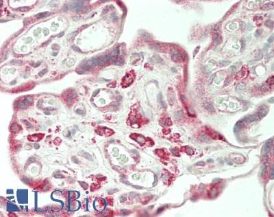 IHC-plus™ Polyclonal Rabbit anti-Human TUBGCP6 / GCP6 Antibody (aa756-795, IHC, WB)