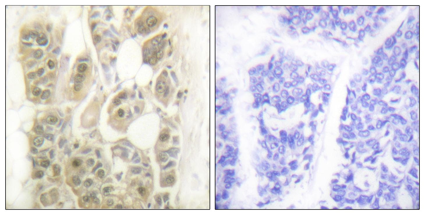 SSB / La Antibody (p366)