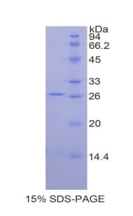 Rat MMP2 Protein (Recombinant His, N-Terminal)