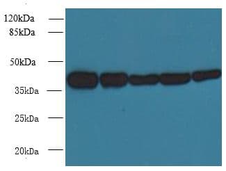 ARPM1 Antibody