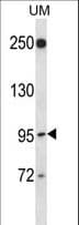 RGL2 Antibody (aa152-180)