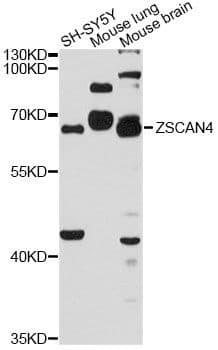 Polyclonal Rabbit anti-Human ZSCAN4 Antibody (WB)