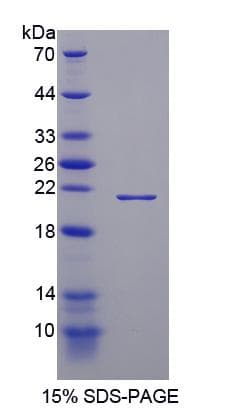 Mouse THBS1 / Thrombospondin-1 Protein (Recombinant His)