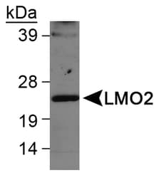 LMO2 Antibody (N-Terminus)