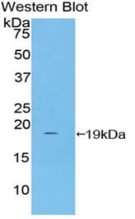 HP / Haptoglobin Antibody (aa168-319)