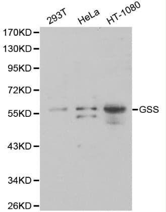 GSS / Glutathione Synthetase Antibody