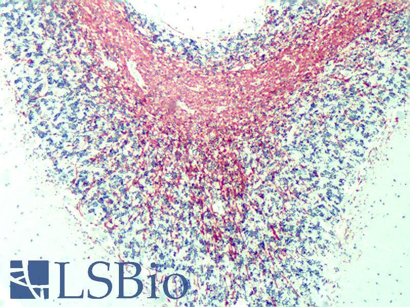 PathPlus™ MBP / Myelin Basic Protein Antibody (aa82-87, clone 12)