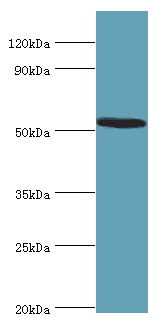 Polyclonal Rabbit anti-Human ATF7 Antibody (aa1-117, IHC, WB)