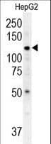 ATP13A3 Antibody (aa101-129)