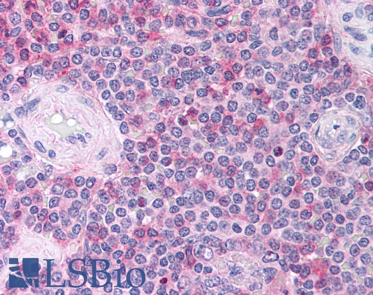 CCL18 / PARC Antibody (C-Terminus)