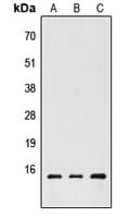 CHRAC1 Antibody (C-Terminus)