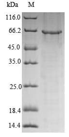 Human GRIN1 / NMDAR1 Protein (Recombinant 6His, N-terminus)