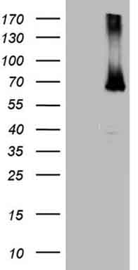 ER Alpha / Estrogen Receptor Antibody (aa1-310, clone OTI9E6)