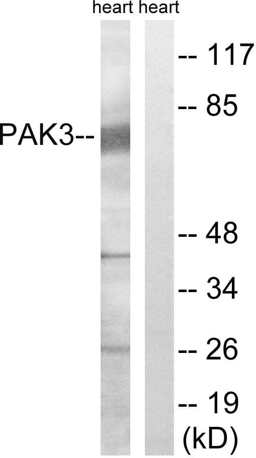 PAK3 Antibody (p154)