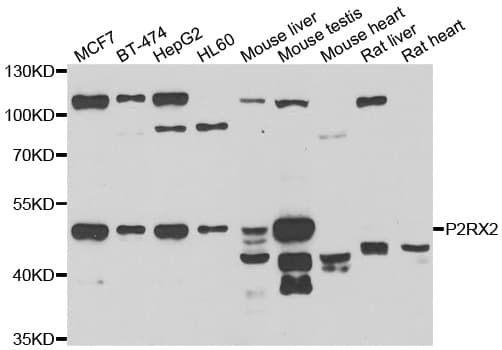 Polyclonal Rabbit anti-Human P2RX2 / P2X2 Antibody (WB)