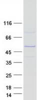 Human PAX5 Protein (Recombinant Myc-DDK (Flag))