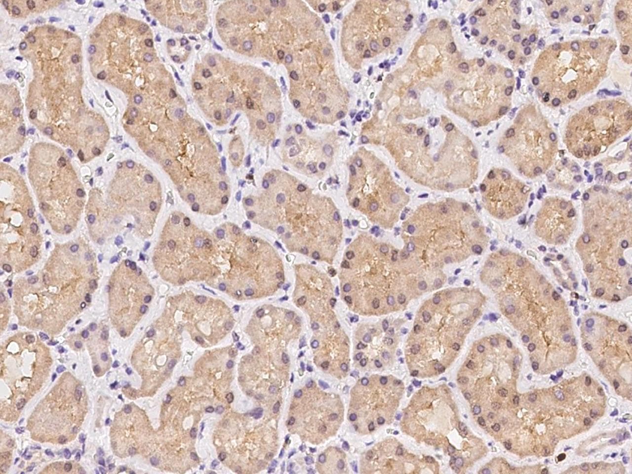 Polyclonal Rabbit anti-Human GHITM Antibody (IHC)