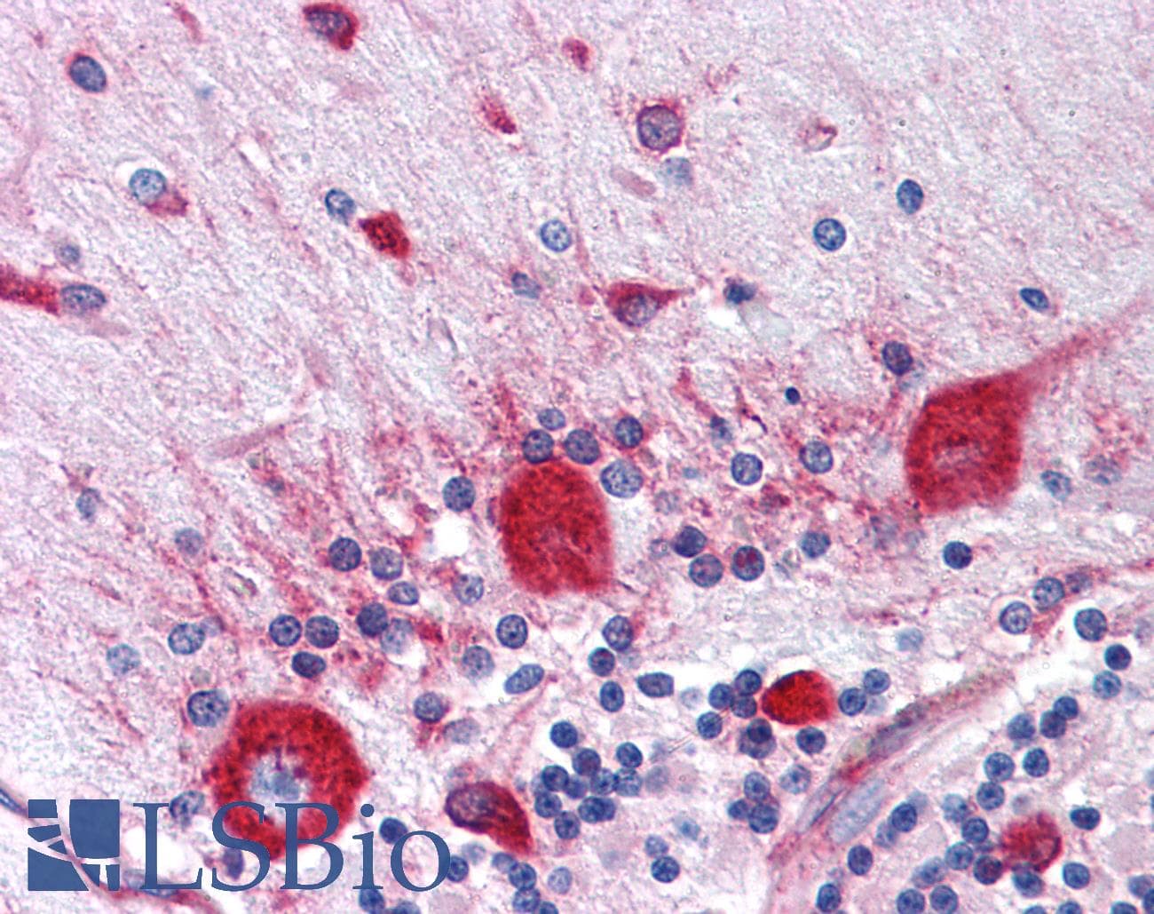 IHC-plus™ RPS2 / Ribosomal Protein S2 Antibody (clone 3G6)