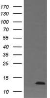 Monoclonal Mouse anti-Human DDT / Dopamine Tautomerase Antibody (clone OTI1A1, IHC, WB)