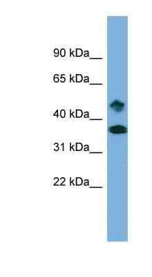 SETD6 Antibody (aa359-408)