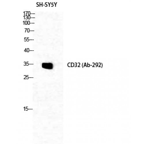 FCGR2 / CD32 Antibody (230-310 aa)