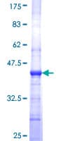 Human PV1 / PLVAP Protein (Recombinant GST, N-terminus)
