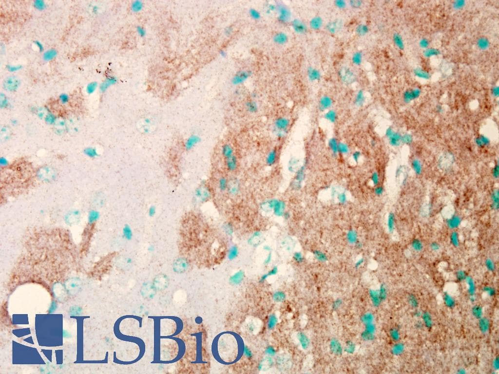 SCN9A / Nav1.7 Antibody (aa1751-1946, clone S68-6, Biotin)