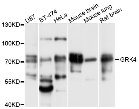 Polyclonal Rabbit anti-Human GRK4 Antibody (WB)