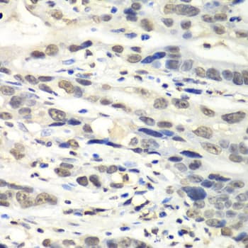 Polyclonal Rabbit anti-Human NUDT1 / MTH1 Antibody (IHC, WB)