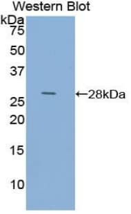 ACTC1 / Alpha Cardiac Actin Antibody (aa156-368)