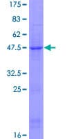 Human CD69 Protein (Recombinant GST)