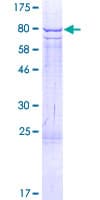Human RPS6KB2 / S6K2 Protein (Recombinant GST)