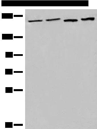Polyclonal Rabbit anti-Human EEA1 Antibody (WB)