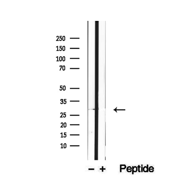 Polyclonal Rabbit anti-Human REEP2 Antibody (IHC, WB)
