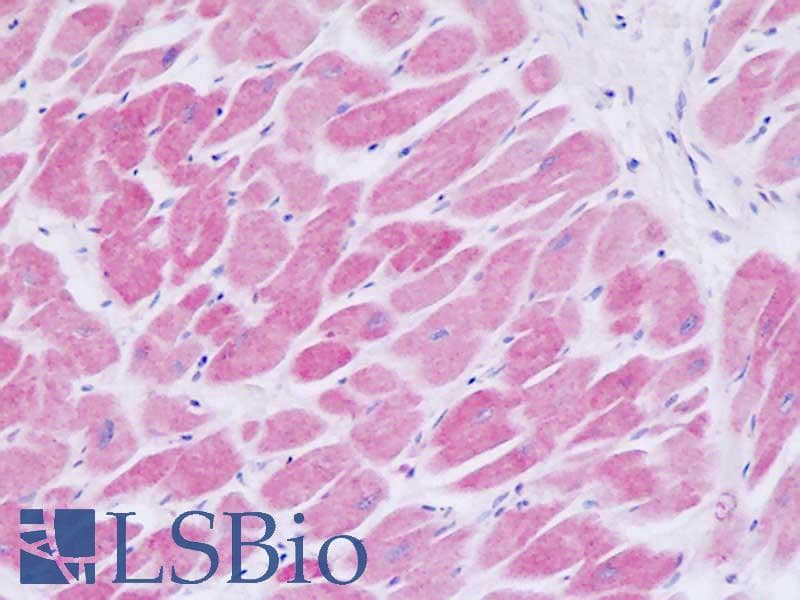 IHC-plus™ ADRB2 Antibody (aa336-385)