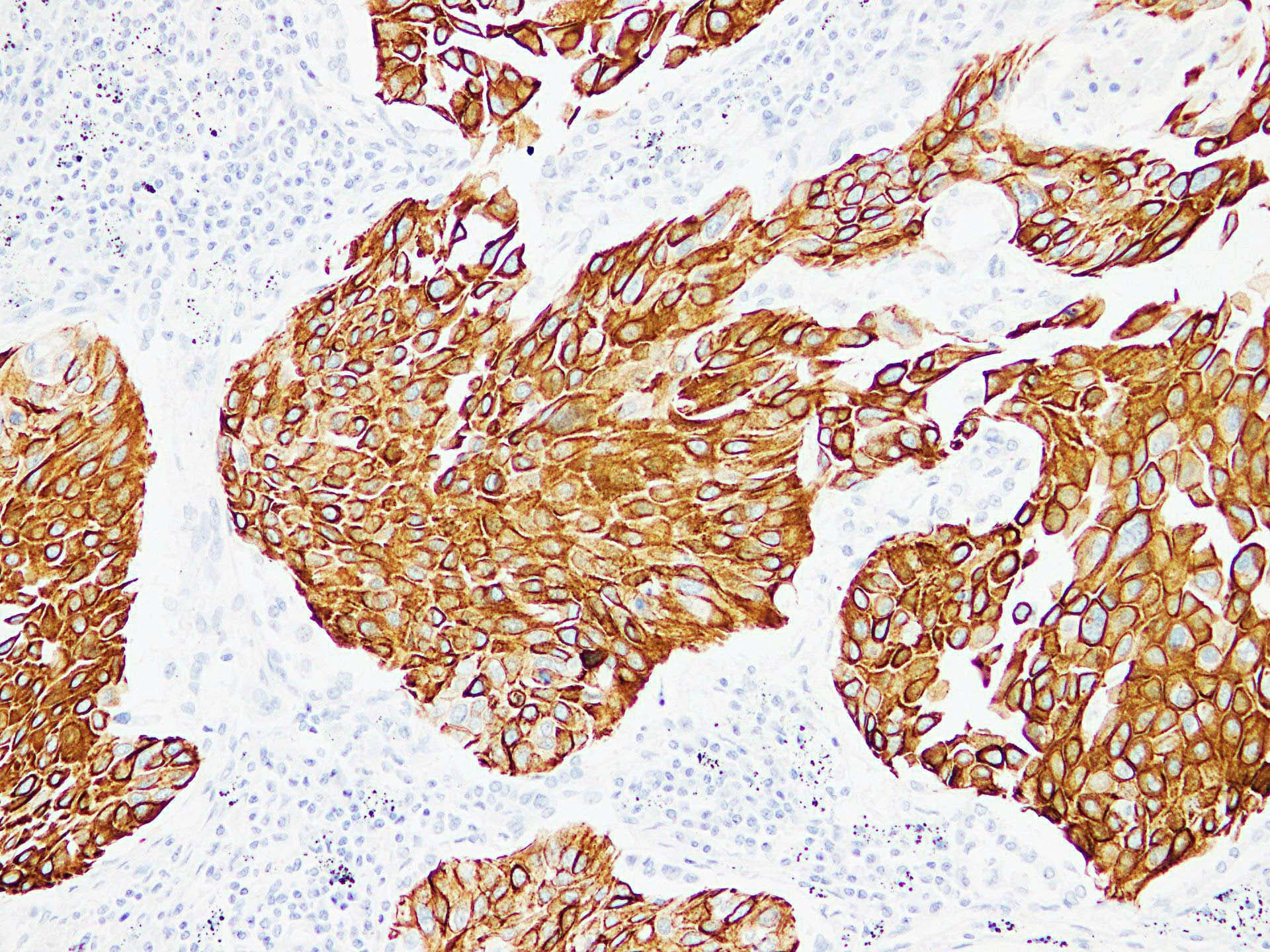PathPlus™ KRT13 / CK13 / Cytokeratin 13 Antibody